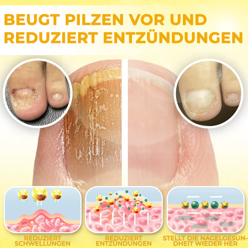 Fivfivgo® ClariNail Bienengift-Pilzlösungstropfen