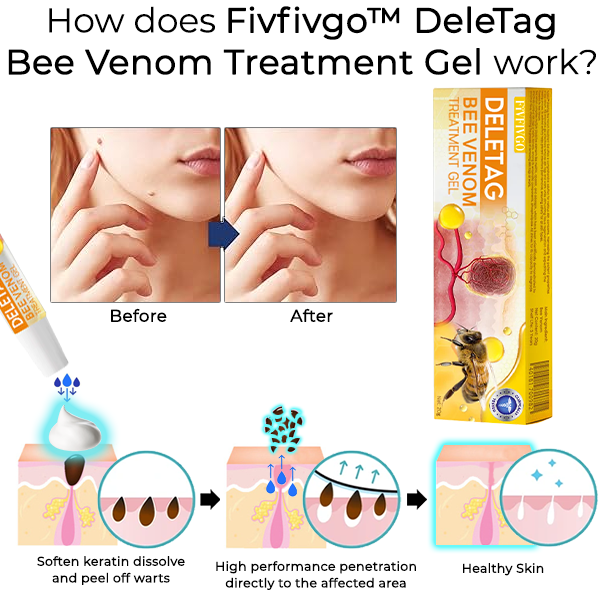 Fivfivgo™ DeleTag Bienengift Behandlung Gel