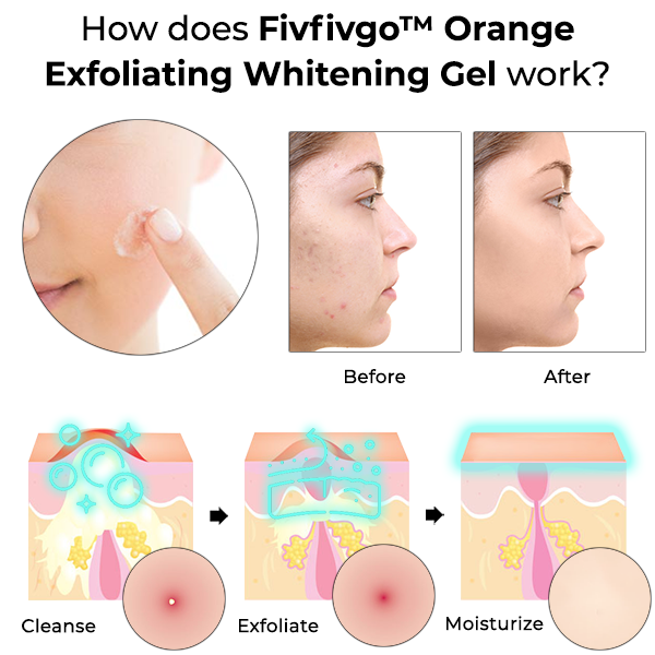 Fivfivgo™ Orange exfolierande blekningsgel