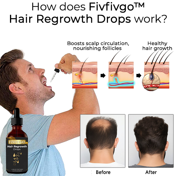 Fivfivgo™ Hair Regrowth Drops
