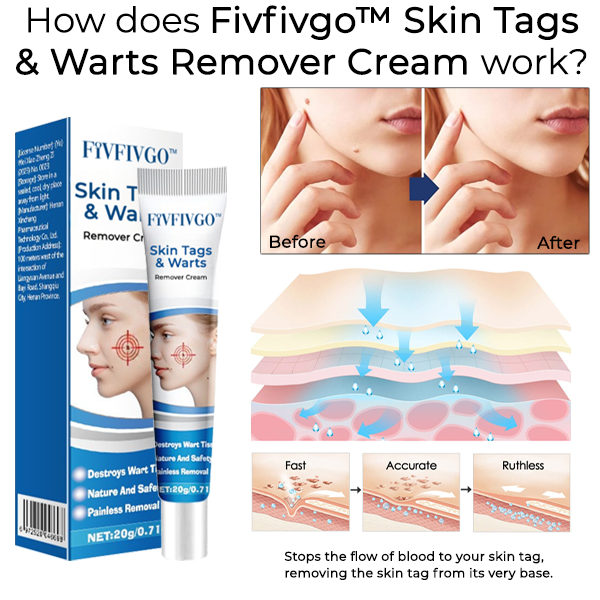 Fivfivgo™ Skin Tags & Warts Remover Cream