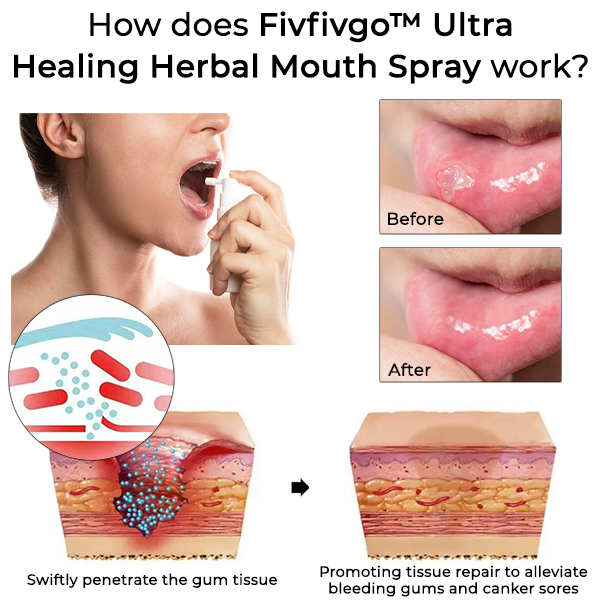 Fivfivgo™ Ultra Heilendes Kräuter-Mundspray