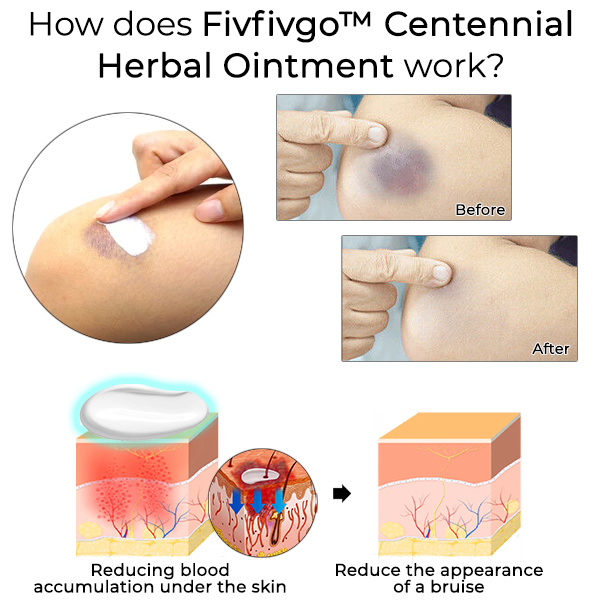 Fivfivgo™ Centennial Herbal Ointment