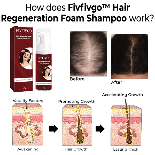 Fivfivgo™ Shampooing mousse régénération des cheveux
