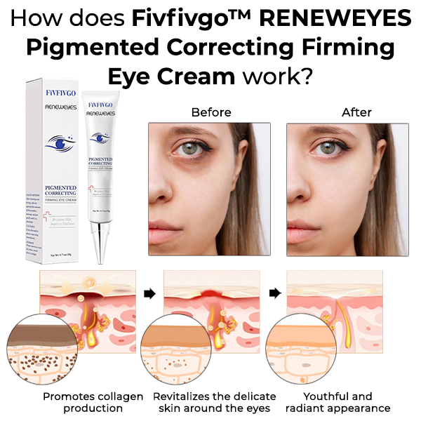 Fivfivgo™ RENEWEYES Pigmenttiä korjaava kiinteyttävä silmänympärysvoide
