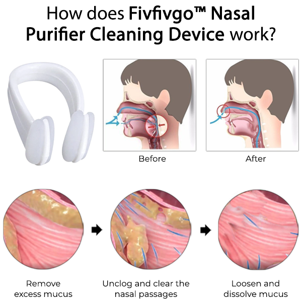 Fivfivgo™ Nasal Purifier Cleaning Device