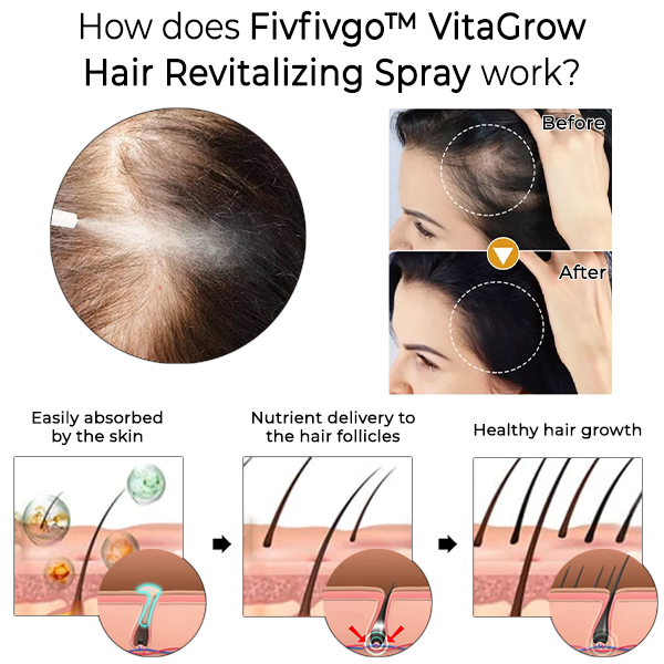 Fivfivgo™ VitaGrow Haarbelebendes Spray