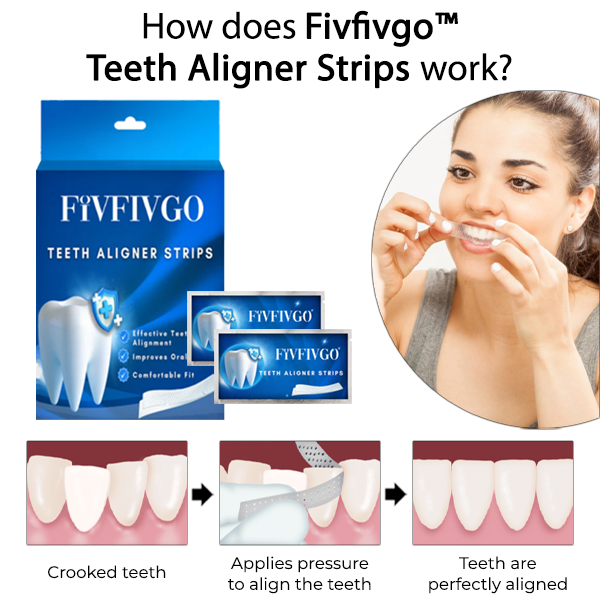 Fivfivgo™ Aligner-Streifen für Zähne