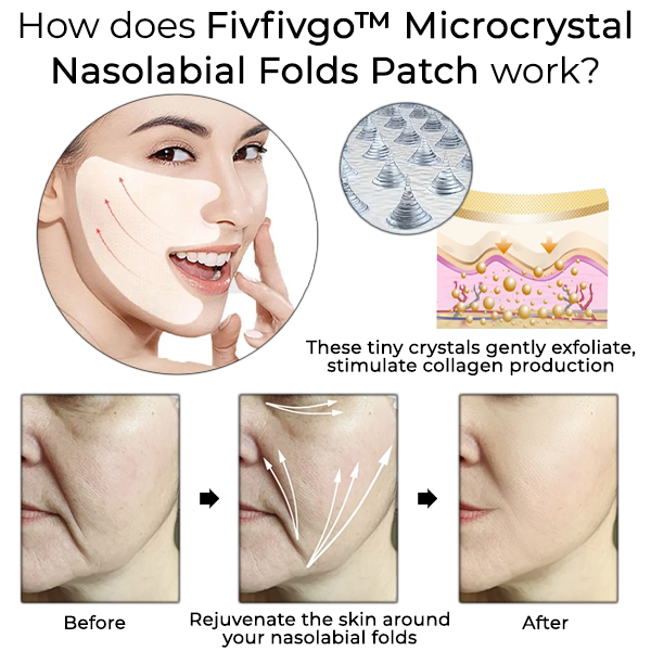 Fivfivgo™ Patch pour les plis nasogéniens en microcristaux