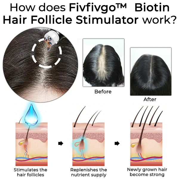 Stimolatore del follicolo pilifero Fivfivgo™ Biotin