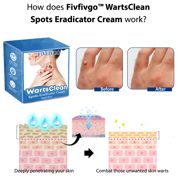 Fivfivgo™ Crème anti-taches WartsClean