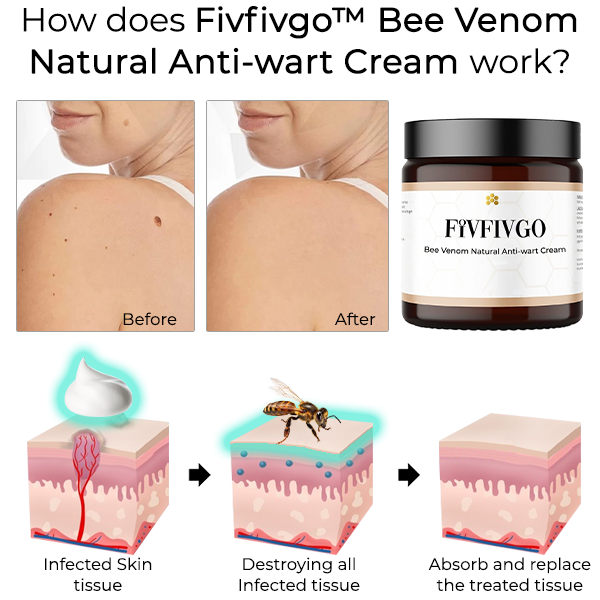 Fivfivgo™ Bee Venom Natural Anti-wart Cream