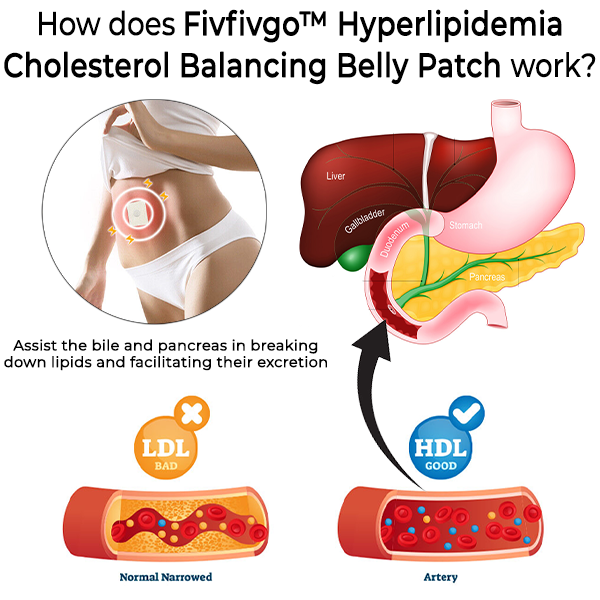 Fivfivgo™ Patch ventral équilibrant le cholestérol pour l’hyperlipidémie