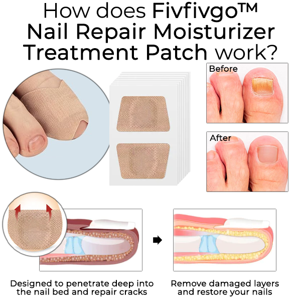 Fivfivgo™ Nail Repair Moisturizer Treatment Patch