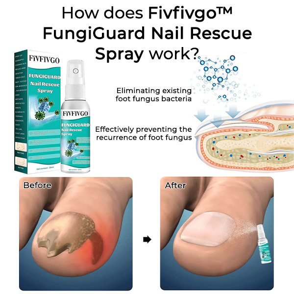 Fivfivgo™ FungiGuard Nail Rescue Spray