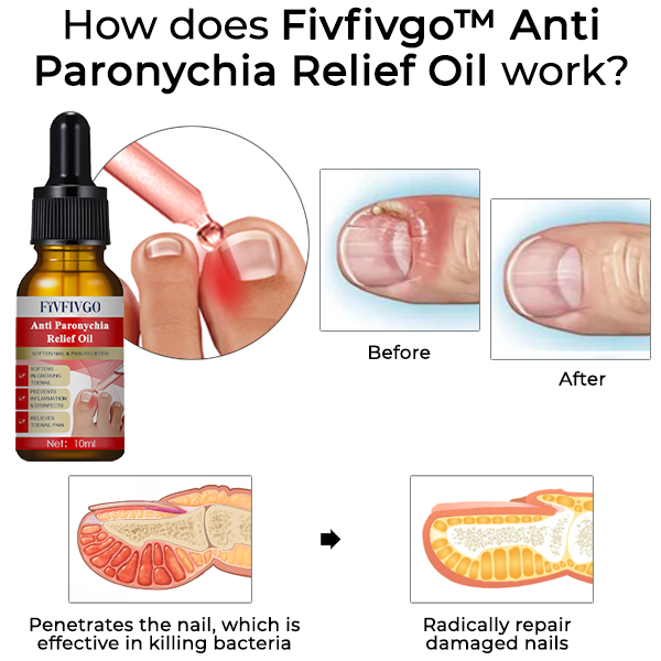 Fivfivgo™ Anti-Paronychie-Linderungsöl