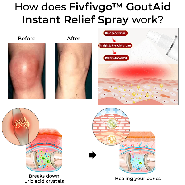 Fivfivgo™ GoutAid Soforthilfe Spray