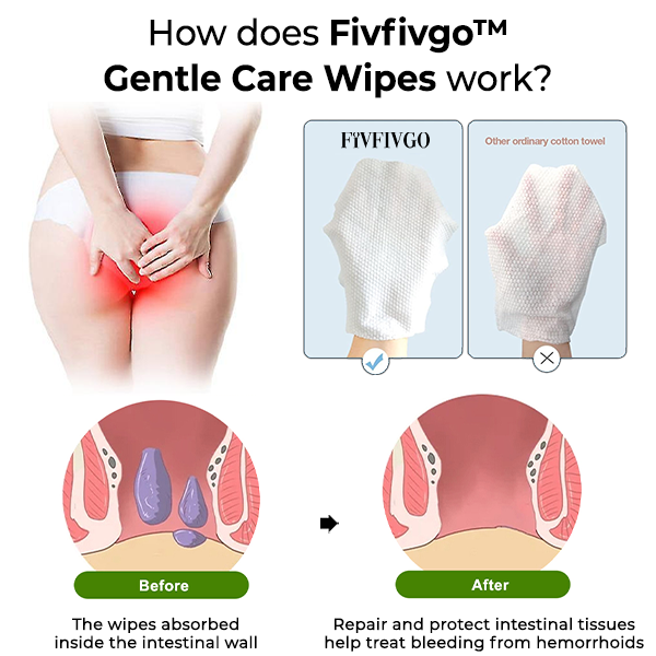 Fivfivgo™ Lingettes de soins doux