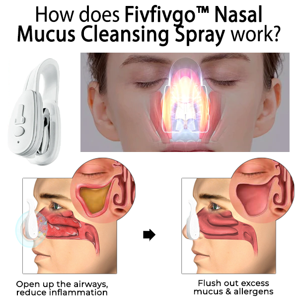 Fivfivgo™ Nasenschleim-Reinigungsgerät