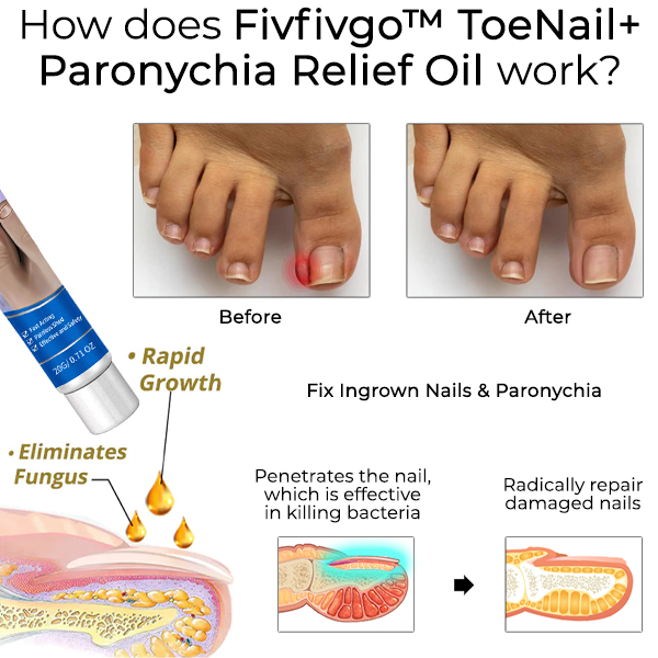 Fivfivgo™ Zehennagel+ Paronychie Linderungsöl