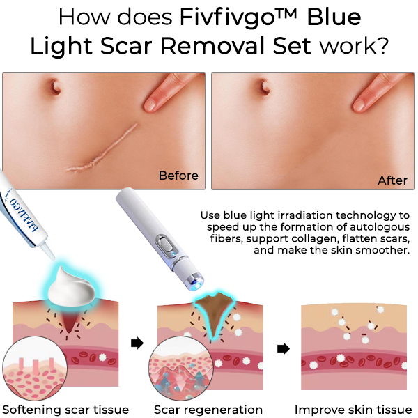 Fivfivgo™ Blue Light Scar Removal Set