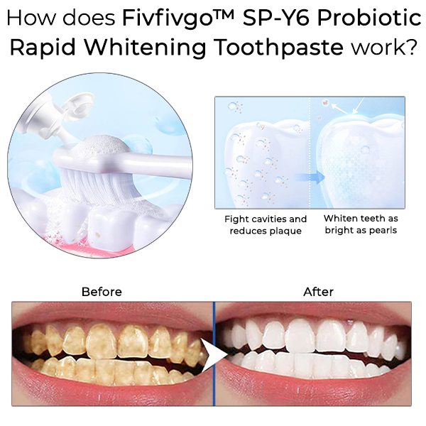 Fivfivgo™ SP-Y6 Dentifrice probiotique à blanchiment rapide