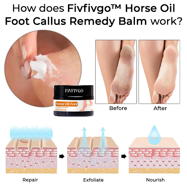 Fivfivgo™ Balsamo rimedio per calli dei piedi all'olio di cavallo