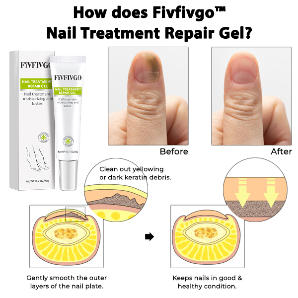 Fivfivgo™ Nail Treatment Repair Gel