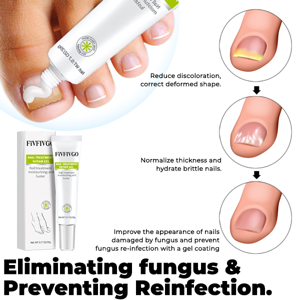 Fivfivgo™ Nail Treatment Repair Gel