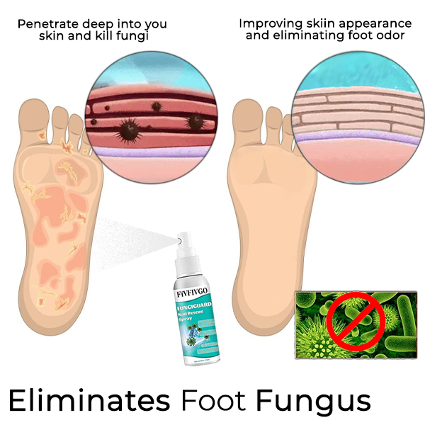 Fivfivgo™ FungiGuard Nagelrettungsspray