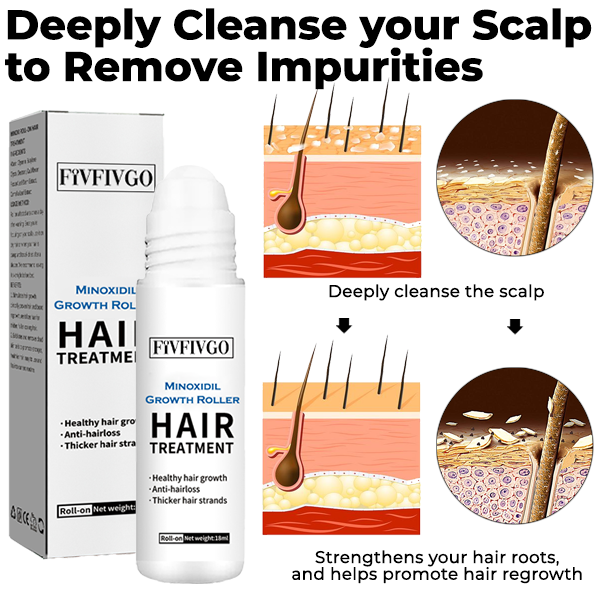 Fivfivgo™ Minoxidil Wachstumsroller