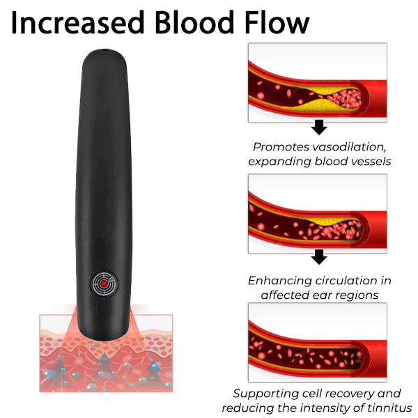 Fivfivgo™ DrWave Acouphènes NerveTreat Thermal Pen