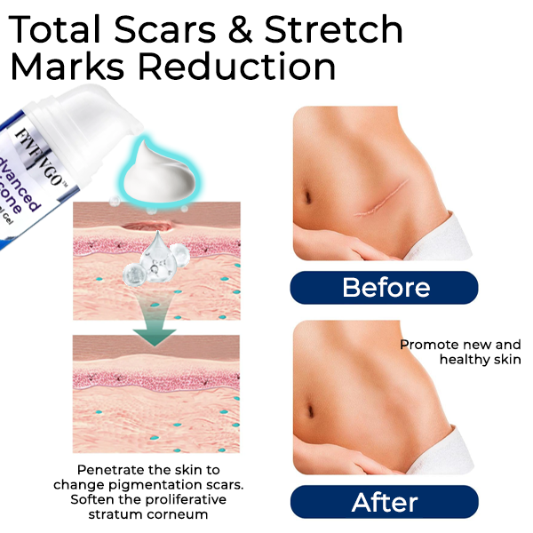 Fivfivgo™ Advanced Silicone Scar Removal Gel