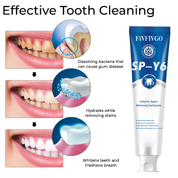Fivfivgo™ SP-Y6 Probiotic Rapid Whitening Toothpaste