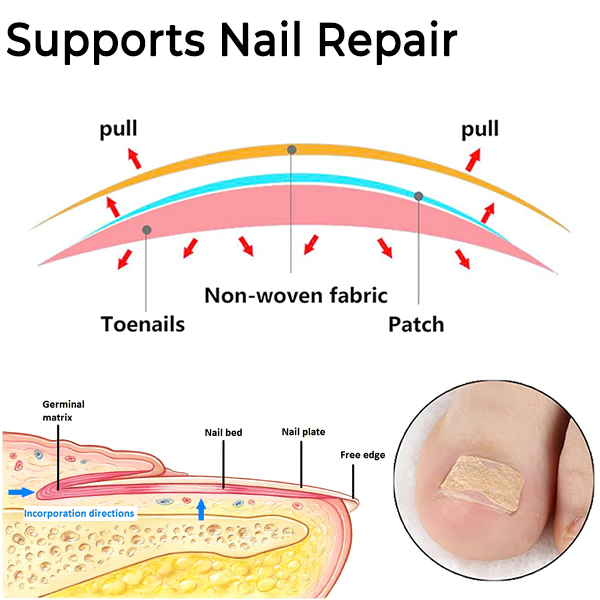 Fivfivgo™ FootRenewal Nail Restoration Patch