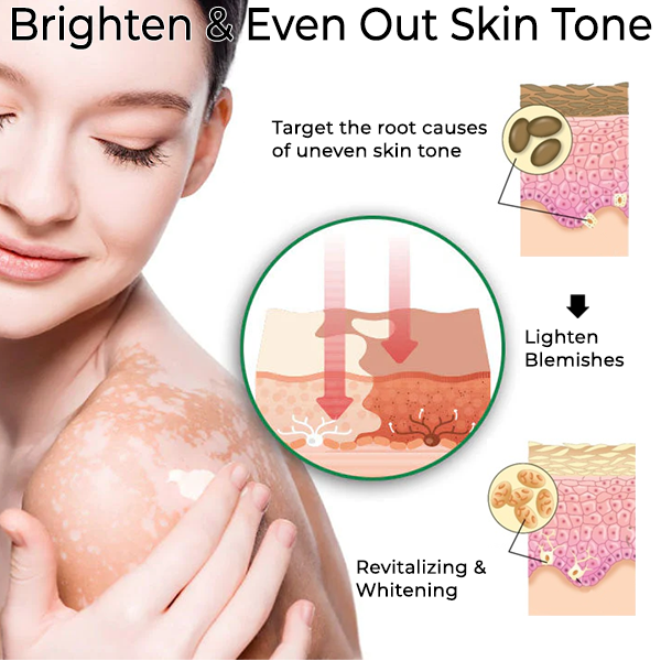 Fivfivgo™ Vitiligo Vanish Crème