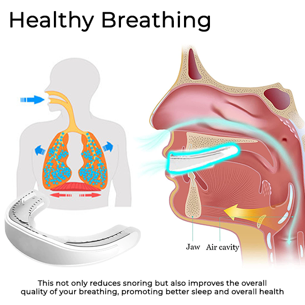 Fivfivgo™ WellSleep Apnea Oral Appliances