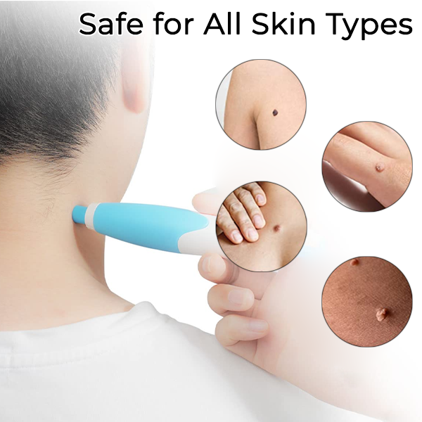 Fivfivgo™ 2-in1 Painless Skin Tag Removal Tool
