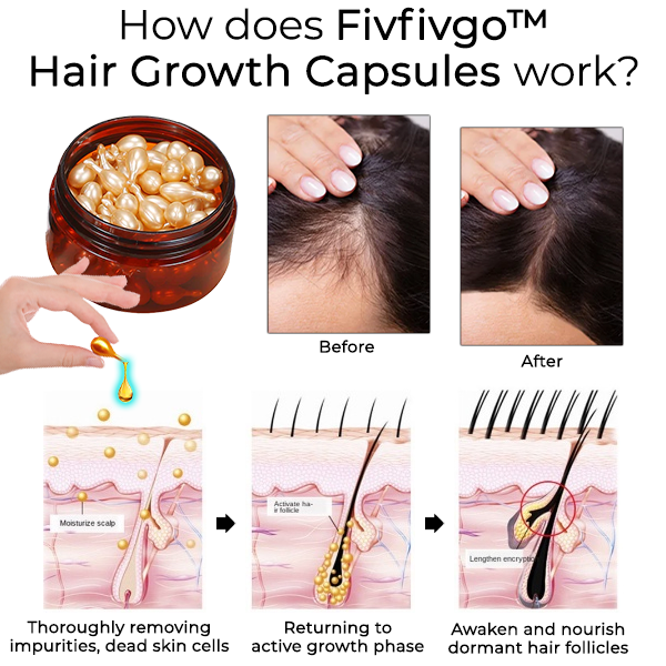 Fivfivgo™ Haarwuchs-Kapseln