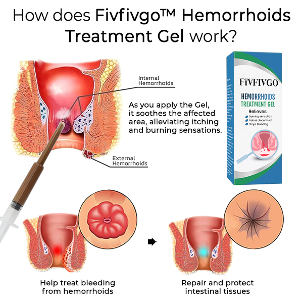Fivfivgo™ Gel zur Behandlung von Hämorrhoiden