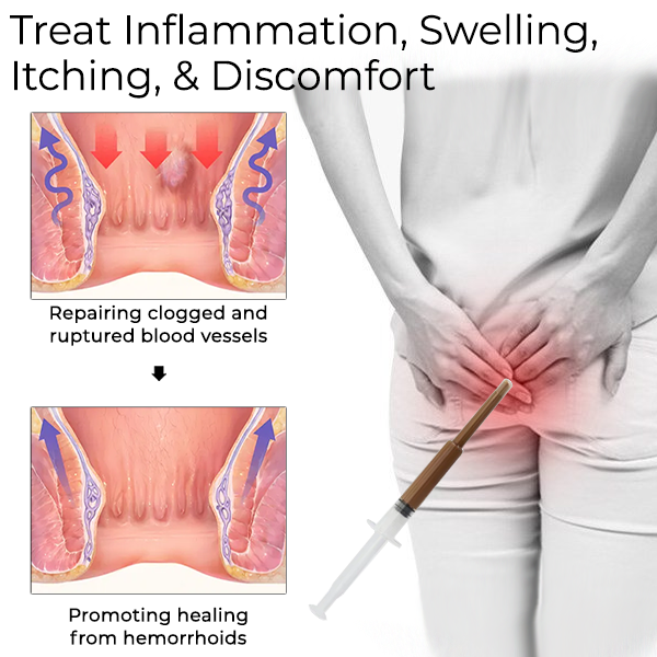 Fivfivgo™ Gel zur Behandlung von Hämorrhoiden