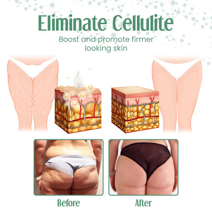 Fivfivgo™ Fortschrittliche hautstraffende Creme (Anti-Falten, fortschrittliche Hautstraffung, Wiederherstellung der Hautelastizität)