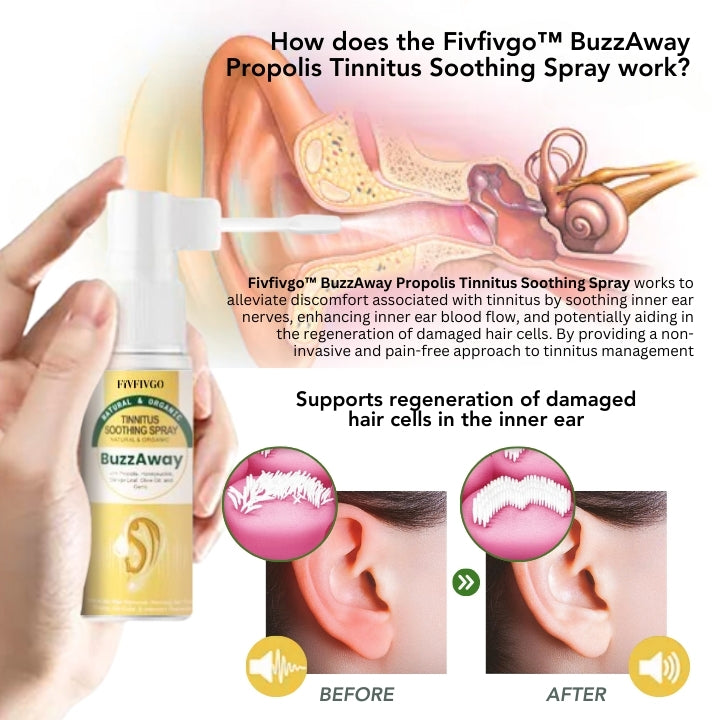 Fivfivgo™ BuzzAway Propolis Spray apaisant les acouphènes