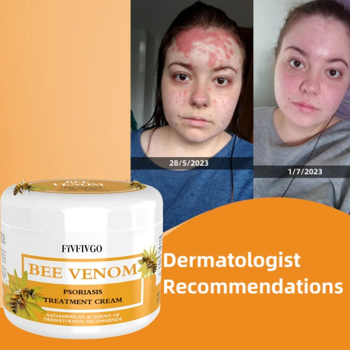 Fivfivgo™ BeeVenom Psoriasis Solution Cream