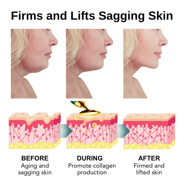 Fivfivgo™ VorSculpt V-Appareil de Remodelage du Visage
