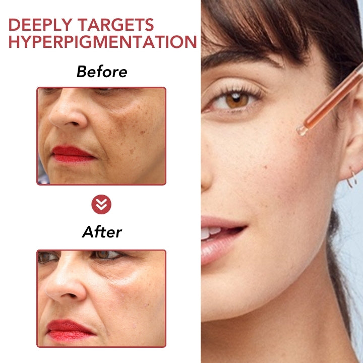 Fivfivgo™ Dark Spot Niacin 10% Correcting Serum