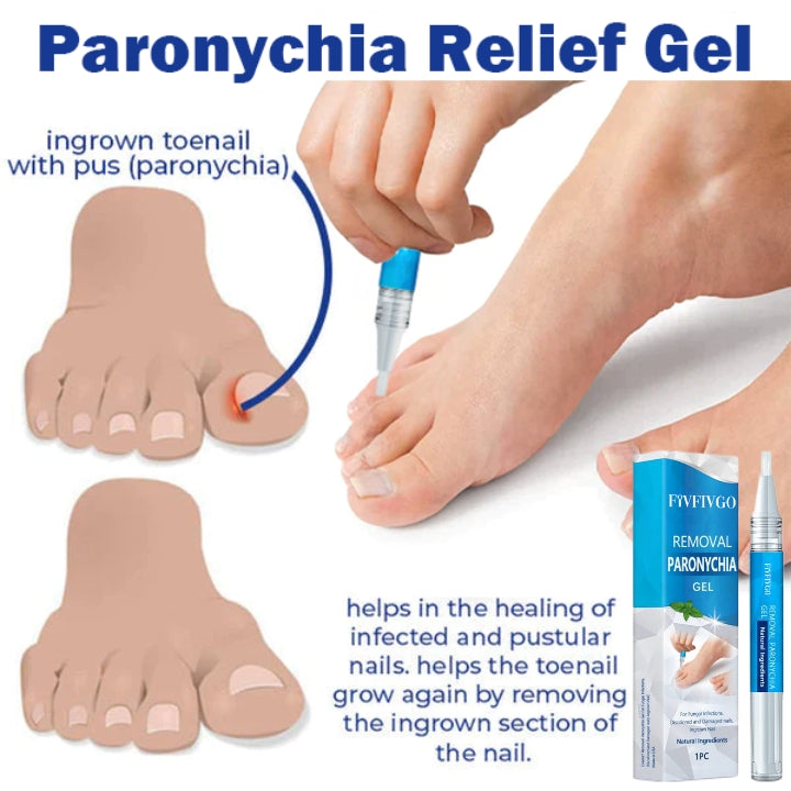 Fivfivgo™ Gel d'élimination des paronychies