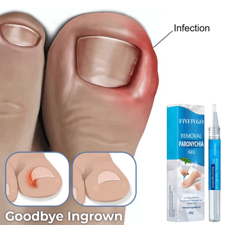 Fivfivgo™ Rimozione del gel per paronichia