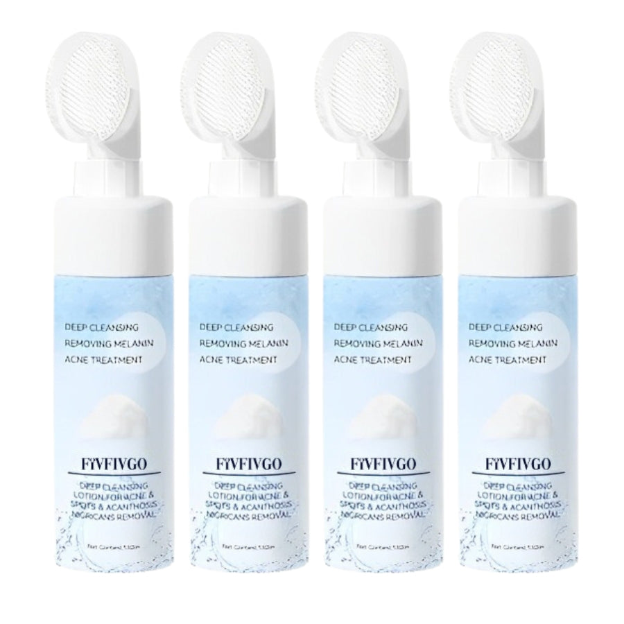 Fivfivgo™ Deep Cleansing Lotion for Acne & Pimples & Acanthosis Nigricans Removal