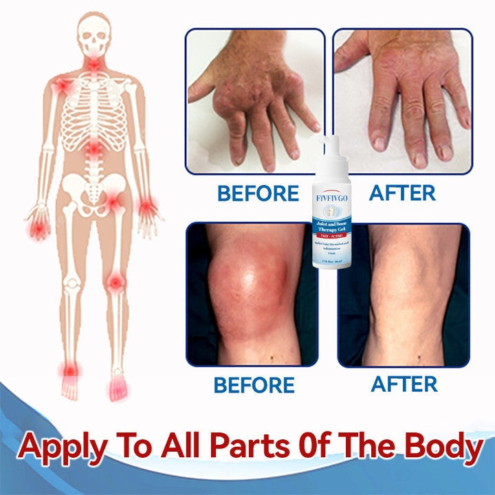 Fivfivgo™ Gel per la terapia delle articolazioni e delle ossa - Recupero completo del corpo